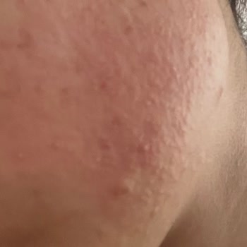 Maruderm Gözenek Arındırıcı Tonik