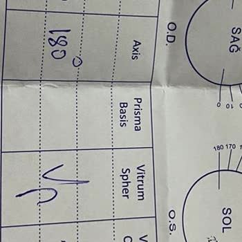 Sancaktepe Bölge Hastanesi Göz Doktorunuz Hk.