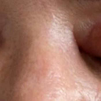 Betül Bingöl Güzellik Merkezi Atakent Şikayet!