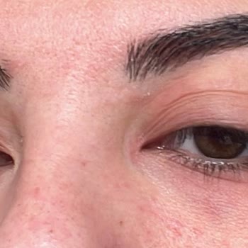 Pastel Kozmetik Pastel Kapatıcı Alerjisi