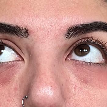 Pastel Kozmetik Pastel Kapatıcı Alerjisi