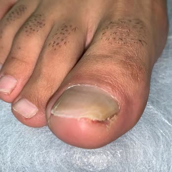 Tırnak Butik Beylikdüzü Batık Tırnak Yaptırmaya Gittik!