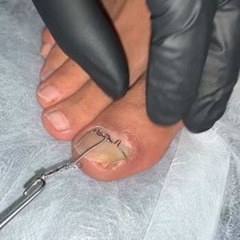 Tırnak Butik Beylikdüzü Batık Tırnak Yaptırmaya Gittik!