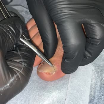 Tırnak Butik Beylikdüzü Batık Tırnak Yaptırmaya Gittik!