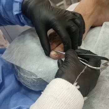 Tırnak Butik Beylikdüzü Batık Tırnak Yaptırmaya Gittik!