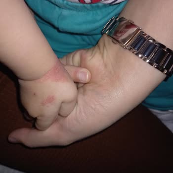 Sağlık Bakanlığı Çocuk Sağlık Hemşireleri