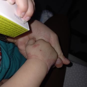 Sağlık Bakanlığı Çocuk Sağlık Hemşireleri