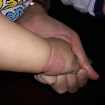 Sağlık Bakanlığı Çocuk Sağlık Hemşireleri