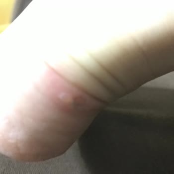 Greyder Yeni Bot Kullanımında Yaşanan Sorunlar Ve Müşteri Memnuniyetsizliği