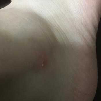 Greyder Yeni Bot Kullanımında Yaşanan Sorunlar Ve Müşteri Memnuniyetsizliği