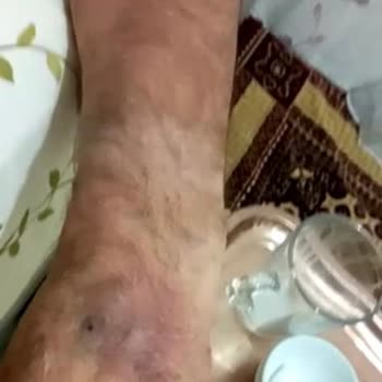 Esencan Hastanesi Hasta Tehdidi