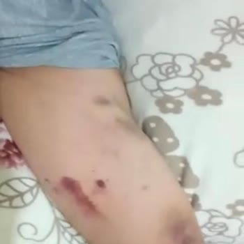 Esencan Hastanesi Hasta Tehdidi