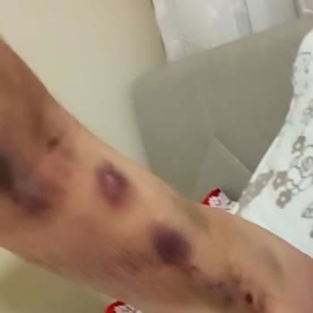 Esencan Hastanesi Hasta Tehdidi