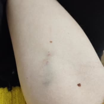 Gümüşhacıköy Devlet Hastanesi Kovulma Saygısız Tavır