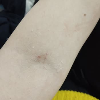 Sağlık Bakanlığı Hastaneden Hemşire Beni Kovdu!