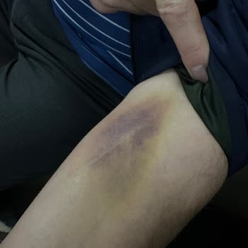 Avrupa Cerrahi Tıp Merkezi Hastane Acil Servisinde Yaşanan Olumsuz Deneyim