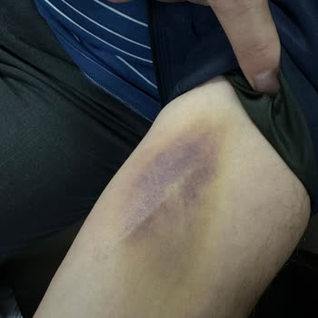 Avrupa Cerrahi Tıp Merkezi Hastane Acil Servisinde Yaşanan Olumsuz Deneyim