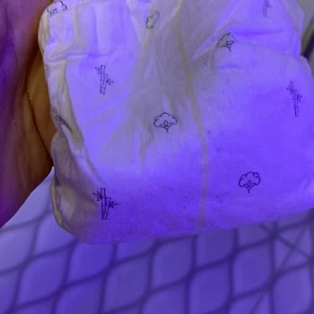 Sleepy 3 Numara Külot Bezde Çıkan Taşlar