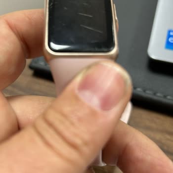 Huawei Band 6 Saat Ve Servis Sorunu