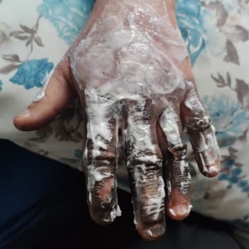 Ussu Bileme Motoru Şikayet