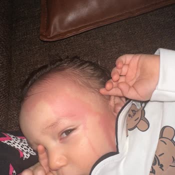 Johnsons Baby Ürünlerin Hepsi Alerjen!