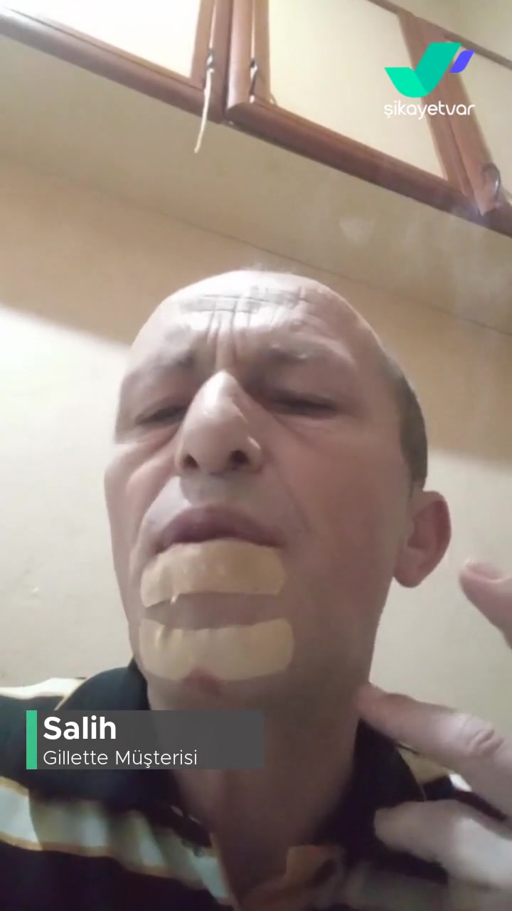 Gillette Blue Yüzümü Parçaladı! videonun kapak resmi