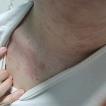 Özel Salihli Hastanesi Özel Hastanede Yaşanan Muayene Memnuniyetsizliği