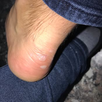 Bulldozer Boyner Ve Buldozerin İnsana Verdiği Değer İade Ve Değişim Yapmıyorlar