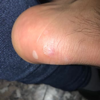 Bulldozer Boyner Ve Buldozerin İnsana Verdiği Değer İade Ve Değişim Yapmıyorlar