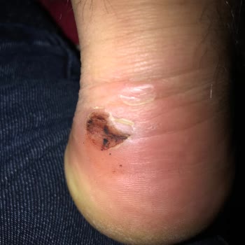 Bulldozer Boyner Ve Buldozerin İnsana Verdiği Değer İade Ve Değişim Yapmıyorlar