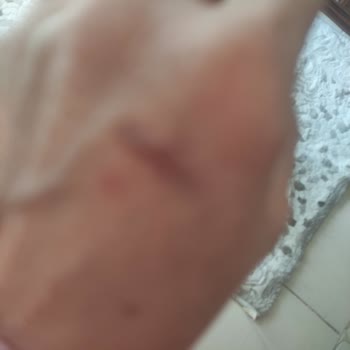 Arçelik Yetkilileri Ve Müşteri Hizmetleri Çamaşır Makinesi İçin Yardım Etmiyor