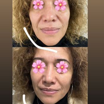 Eki aç