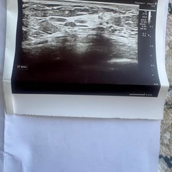 İrmet Hospital Kendi Yaptığı Ameliyat Hatası Ücret İstiyor