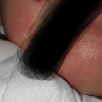 Pure Baby Kanamalı Pişik Ve Uykusuz Geceler