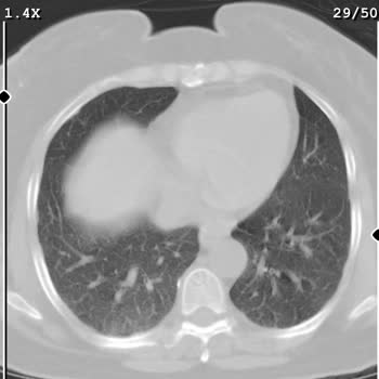 Central Hospital Tıbbi Görüntüleme Mağduriyeti