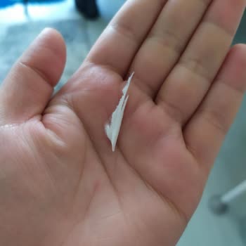 Molfix Bezin İçinden Çıkan Beyaz Sert Cisim