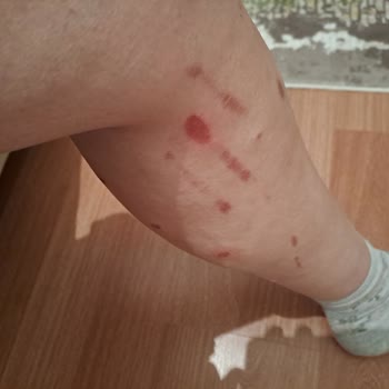 Rönesans Vip Güzellik Salonu Yozgat Sorgun Lazer Merkezi