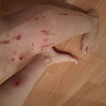 Rönesans Vip Güzellik Salonu Yozgat Sorgun Lazer Merkezi