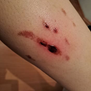 Rönesans Vip Güzellik Salonu Yozgat Sorgun Lazer Merkezi