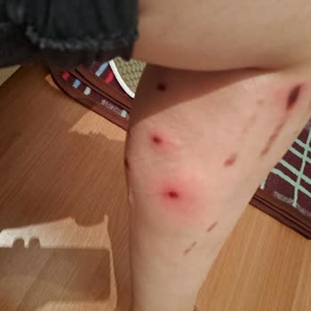 Rönesans Vip Güzellik Salonu Yozgat Sorgun Lazer Merkezi