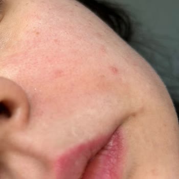 Etat Pur Ürün Cildimi Çok Kuruttu