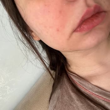 Etat Pur Ürün Cildimi Çok Kuruttu