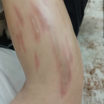 Lavinya Golden Konya Mağduriyet Yaşama