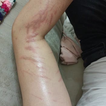 Lavinya Golden Konya Mağduriyet Yaşama