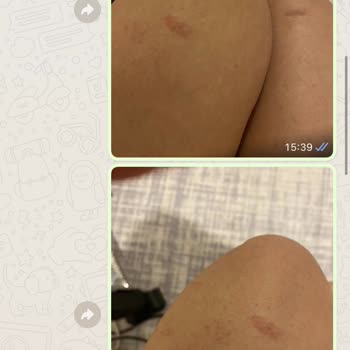Estetika Güzellik Merkezinde Yaşanan Sorunlar Hakkında CİMER Şikayeti