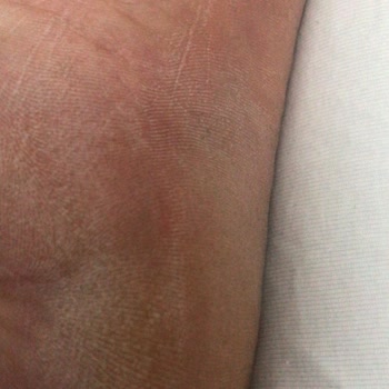 Halbuqi Trend Ayakkabıda Metal Parça Hüsranı