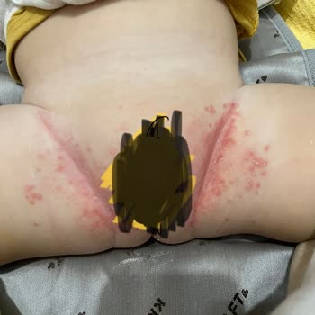 Prima Bez Pişik Yaptı