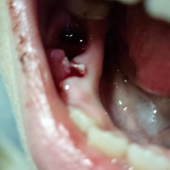 Aydın Ağız Ve Diş Sağlığı Merkezi O Daha Çocuk