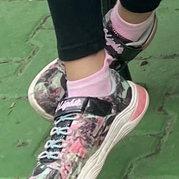 Skechers Çocuk Ayakkabısı Koku Yapıyor!