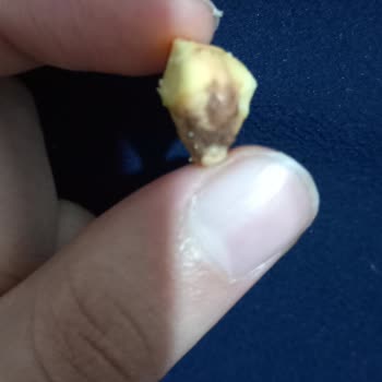 Cino Çikolata'dan Taş Çıktı